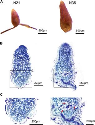 Genome-Wide Analysis of Long Non-coding RNAs Involved in Nodule Senescence in Medicago truncatula
